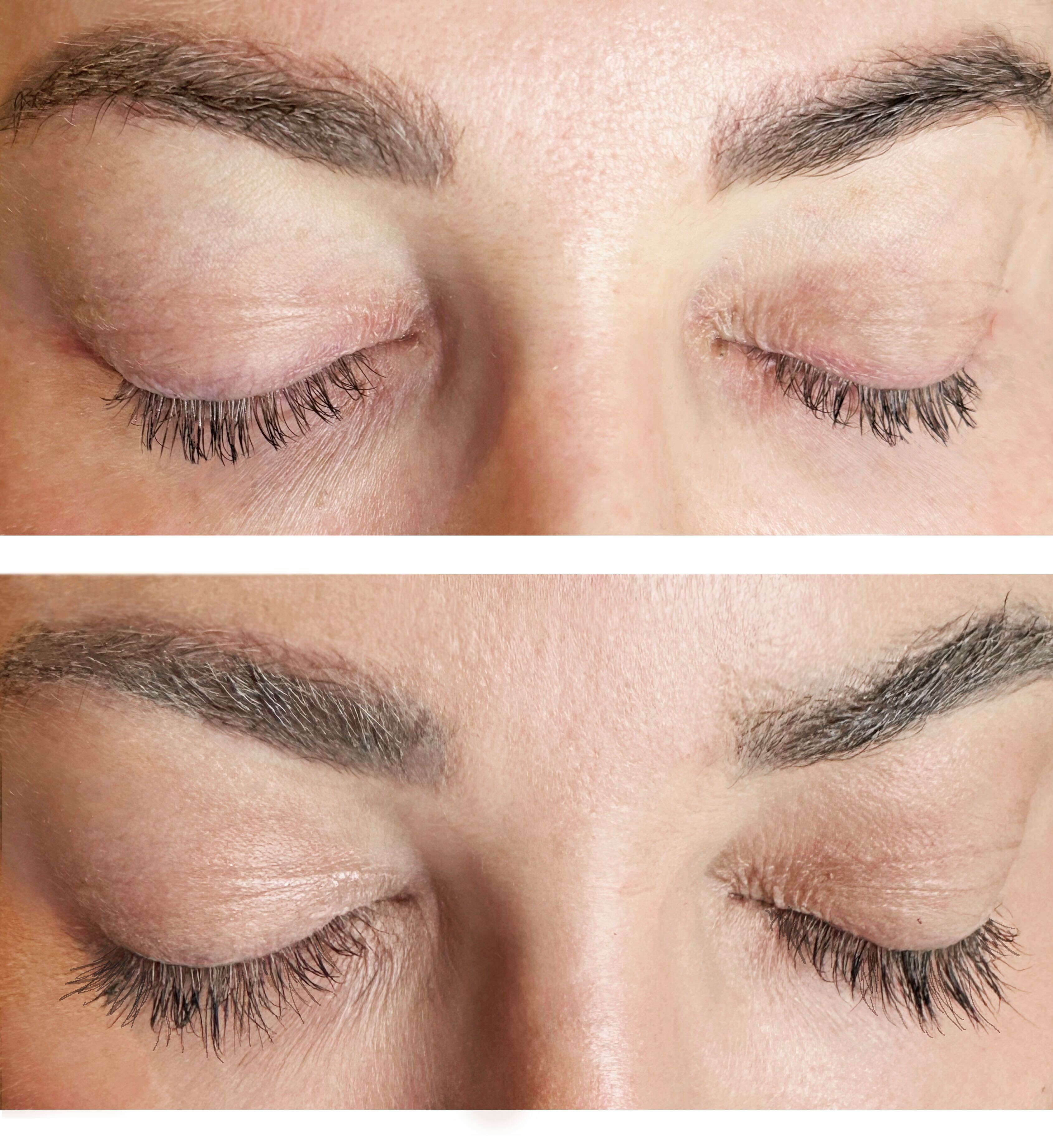 Before and After