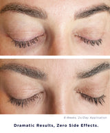 Plume Elite Lash & Brow Enhancing Serum | Safe Alternative to Prostaglandin | Zero Side Effects
