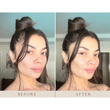 Instant Hairline Scalp-stick