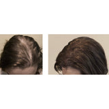 Instant Hairline Scalp-stick