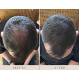 Instant Hairline Scalp-stick