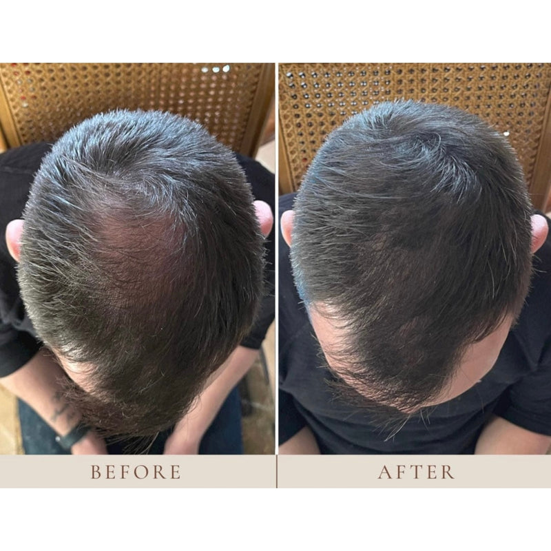 Instant Hairline Scalp-stick