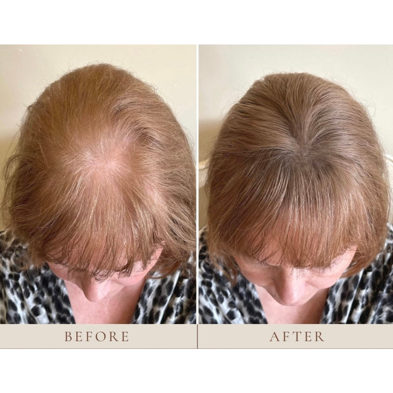 Instant Hairline Scalp-stick