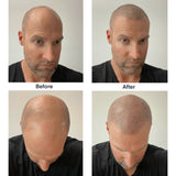 Instant Hairline Scalp-stick